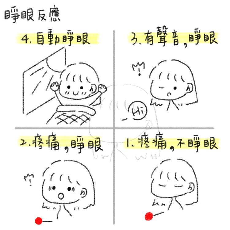 睜眼反應（E, Eye opening）